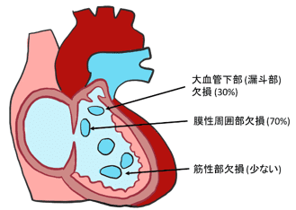 図３：あなの開いている場所による分類
