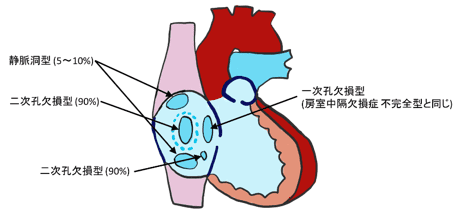 図6：あなの開いている場所による分類