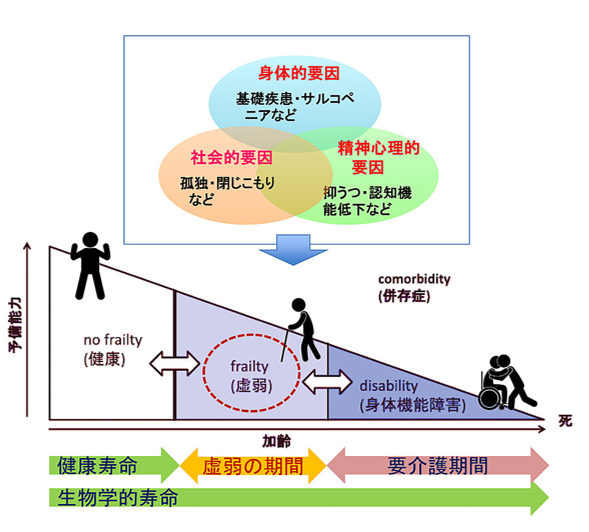 介護の原因となるフレイルを回避せよ！